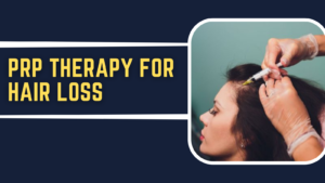 How Platelet-Rich Plasma Therapy Helps Regrow Lost Hair