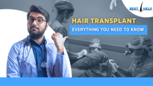 Hair Transplant: Everything You Need to Know