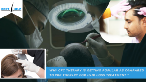 Why GFC Therapy Is Getting Popular As Compared To PRP Therapy For Hair Loss Treatment ?