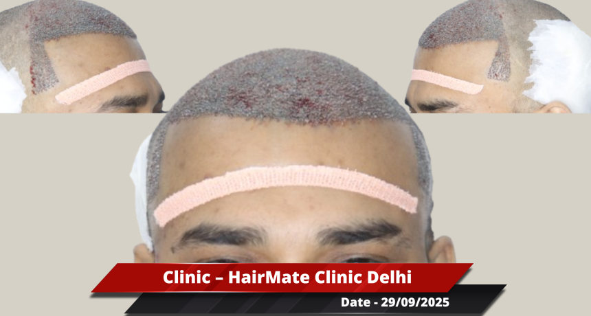 Delhi