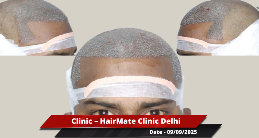 Delhi