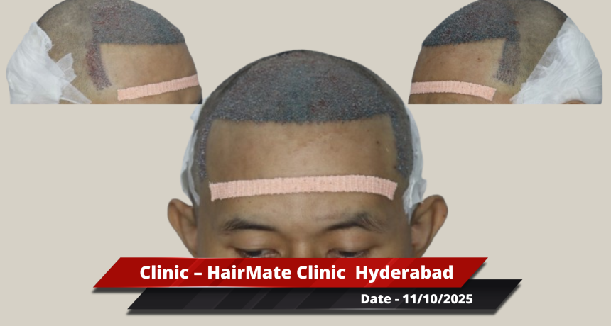 Hyderabad