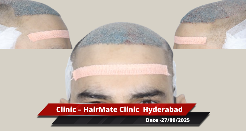 Hyderabad