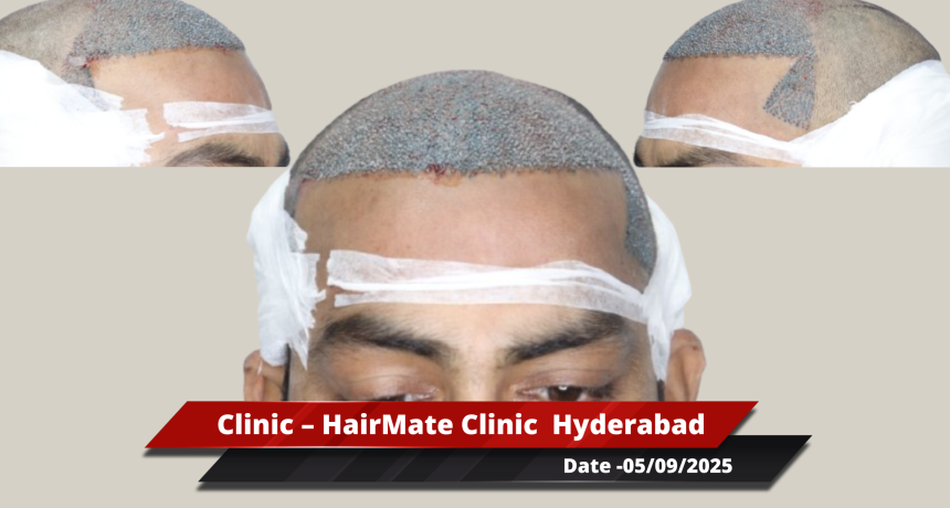 Hyderabad