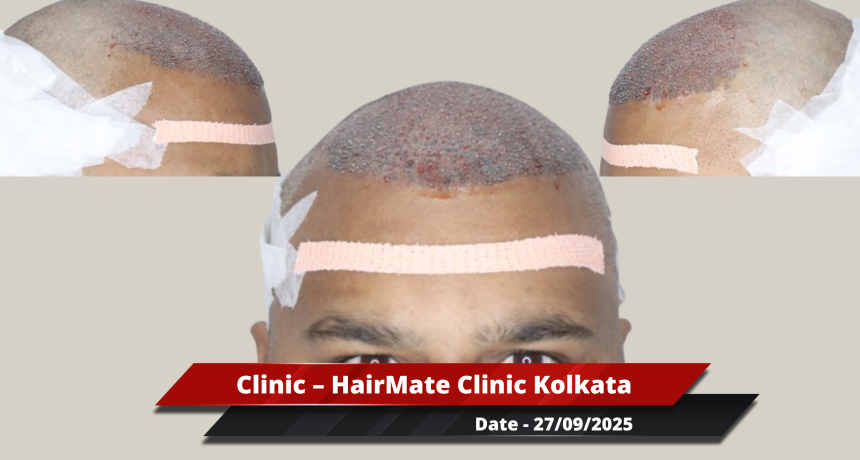 Kolkata