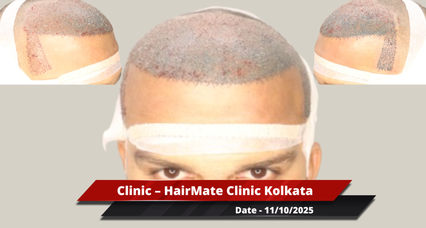 Kolkata