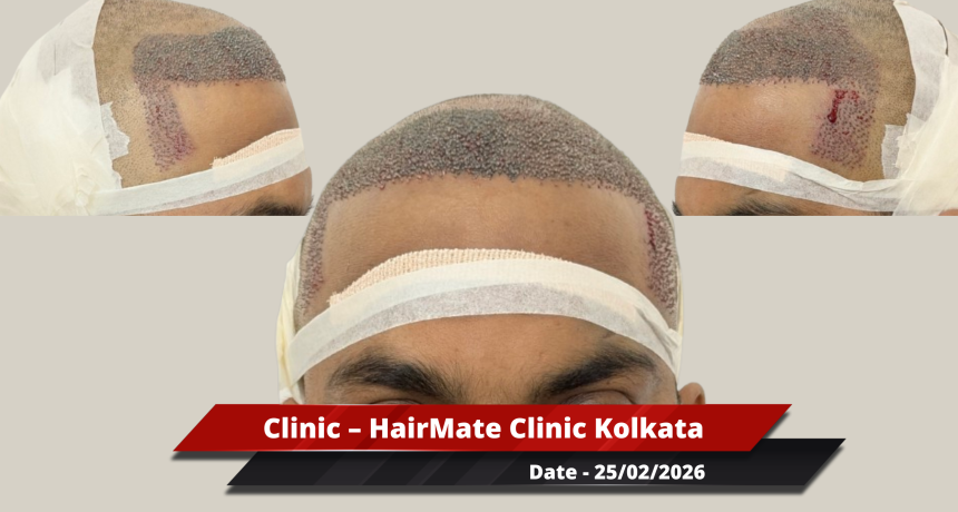 Kolkata