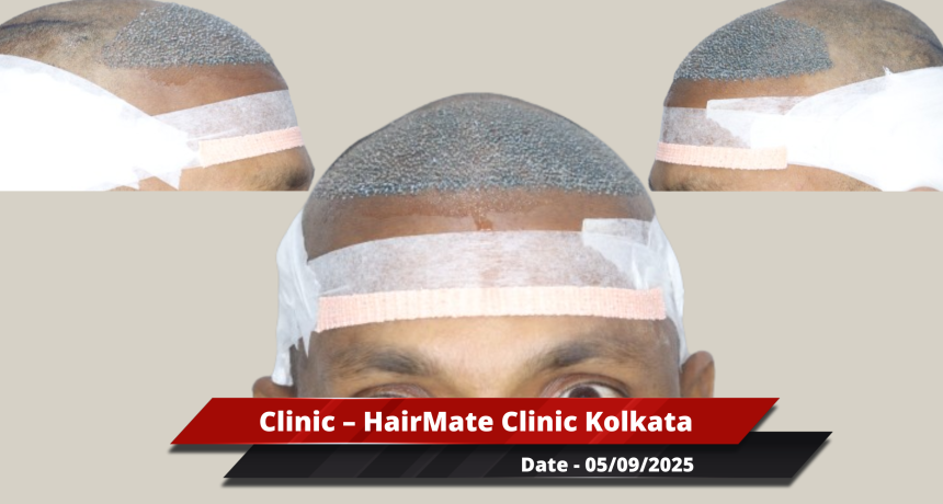 Kolkata