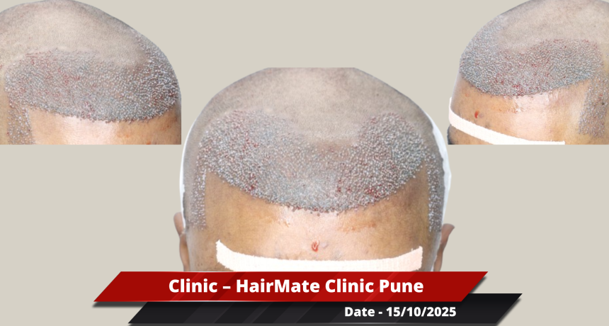Pune