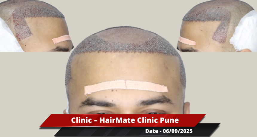 Pune