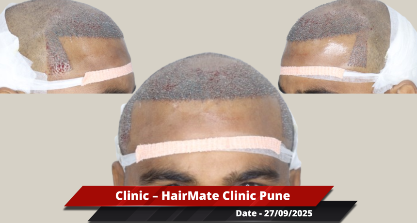 Pune