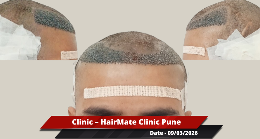 Pune